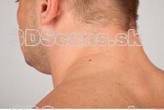 Neck texture of Gene 0003